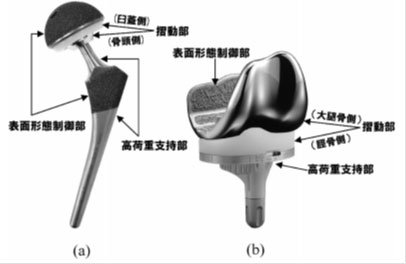 人工関節